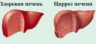 ������ ������� � �������� b c � ������